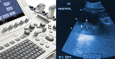 Máquina de ecografía urológica