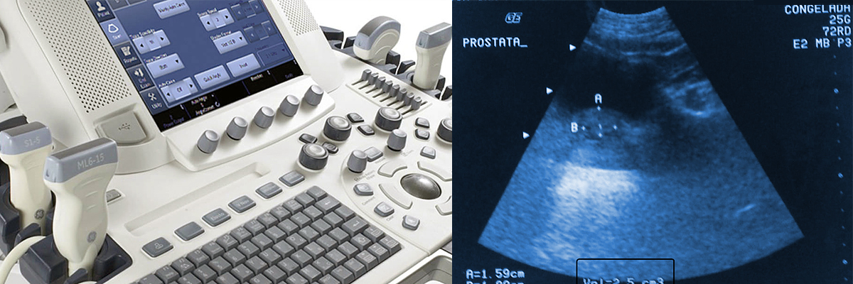 Máquina de ecografía urológica